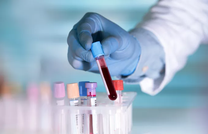Κορωνοϊός: Επηρεάζει η ομάδα αίματος την πιθανότητα λοίμωξης;- Τί δείχνει νέα μελέτη