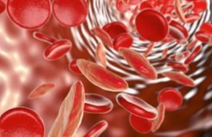 Θεσσαλονίκη: Πώς τα αιμοποιητικά κύτταρα θεραπεύουν τη λευχαιμία	