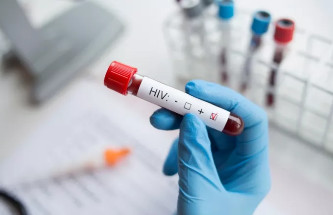 Προειδοποίηση ΠΟΥ: Η καταπολέμηση του HIV επιβραδύνθηκε λόγω της Covid