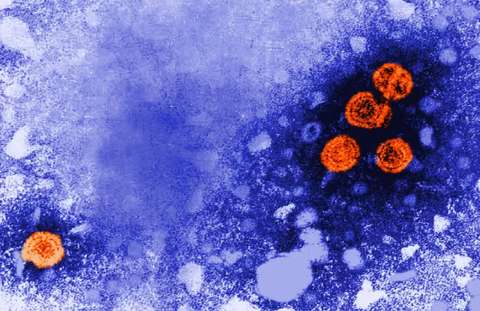 Ο ΠΟΥ καταμετρά 348 κρούσματα ηπατίτιδας άγνωστης προέλευσης σε 20 χώρες