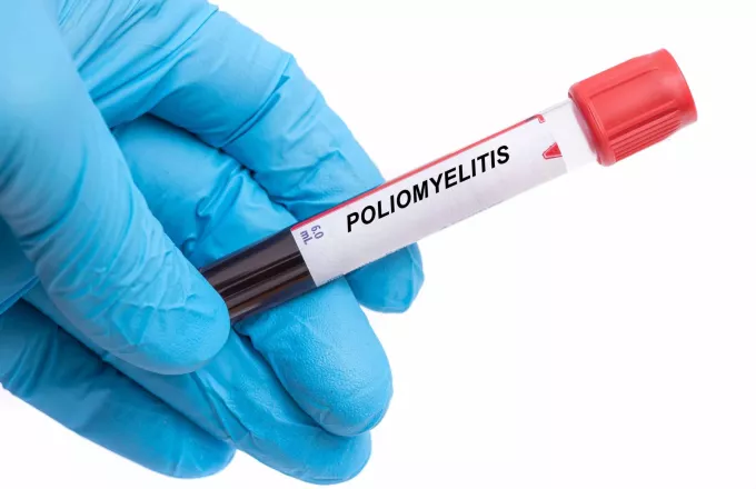 Πολιομυελίτιδα