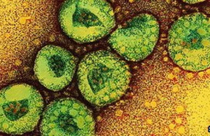 Μπέρδεμα με το όνομα του κορωνοϊού: SARS-CoV-2 ο ιός, Covid-19 η νόσος