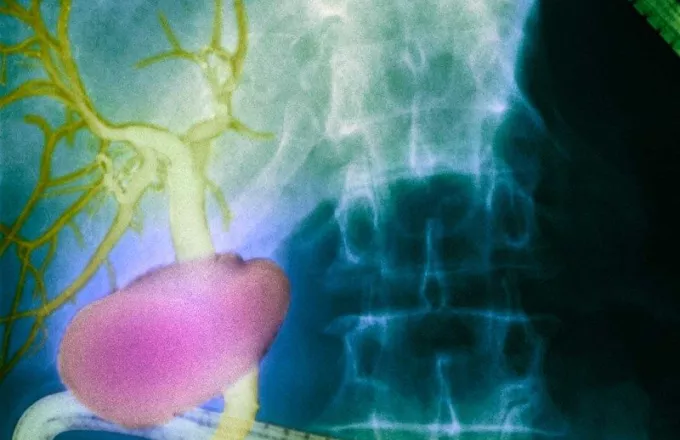 Ανακαλύφθηκε αόρατο όργανο στο ανθρώπινο σώμα - Ελπίδα για τον καρκίνο