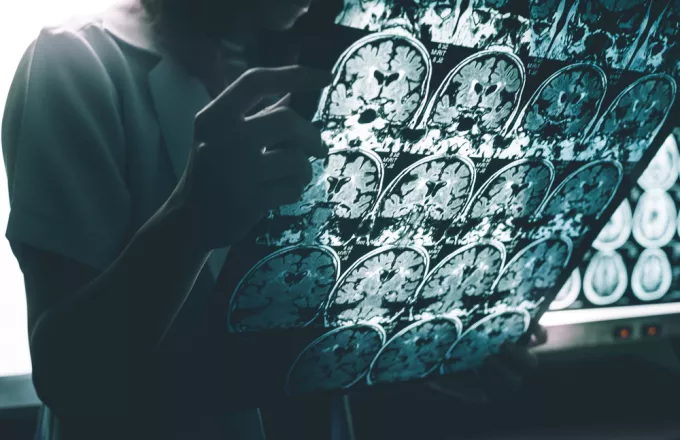 Δοκιμάστηκε ο πρώτος βηματοδότης εγκεφάλου σε ασθενείς με Αλτσχάιμερ