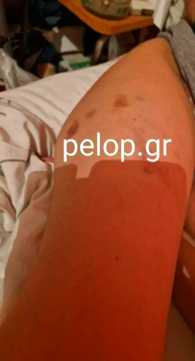 Κακοποίηση