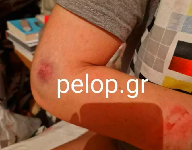 Κακοποίηση