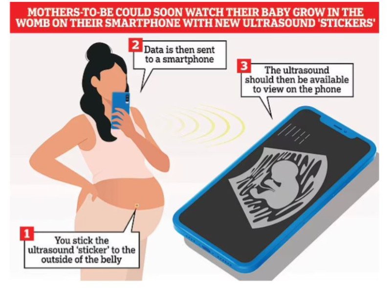 Οι έγκυες θα παρακολουθούν το μωρό τους από το κινητό τους 