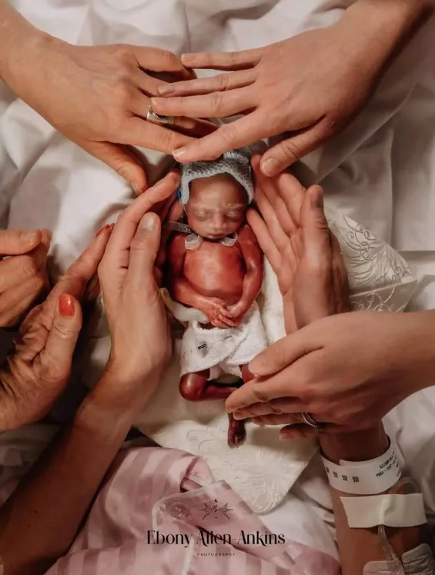 Ο διαγωνισμός «Birth Photography Image Competition»