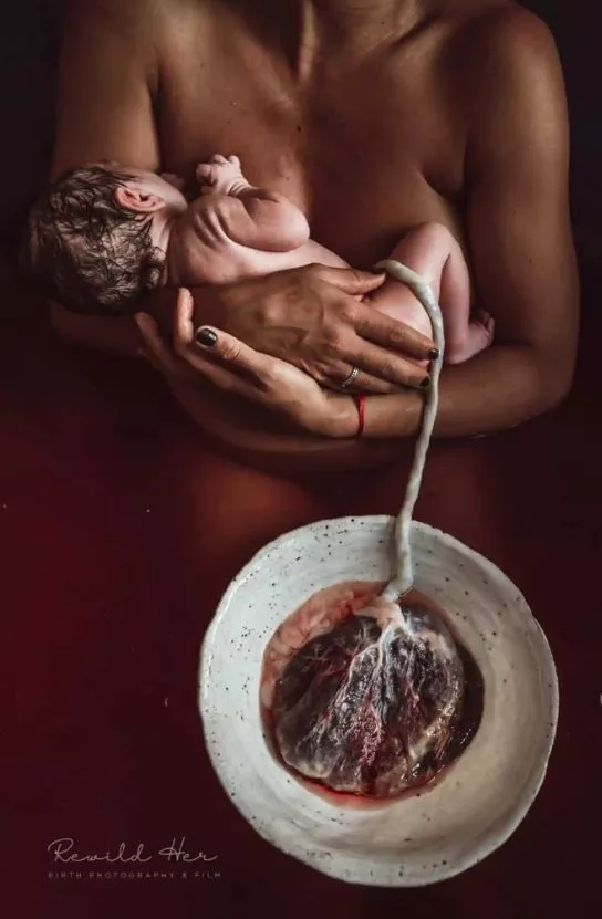 Ο διαγωνισμός «Birth Photography Image Competition»