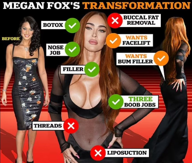 Οι πλαστικές της Megan Fox 