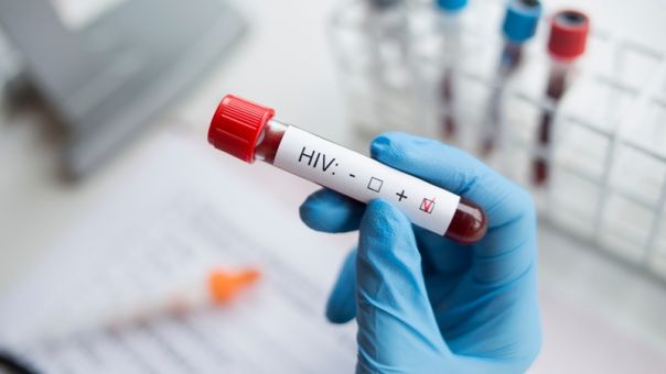 Ανακαλύφθηκε στην Ευρώπη νέα, πιο παθογόνα και μεταδοτική, παραλλαγή του ιού HIV του AIDS