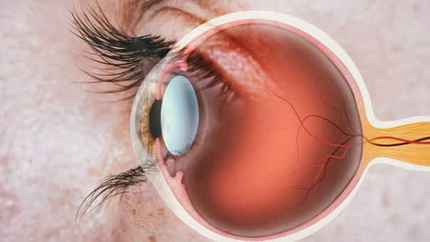 Πώς ο αμφιβληστροειδής των ματιών «μαρτυρά» τον κίνδυνο θανάτου
