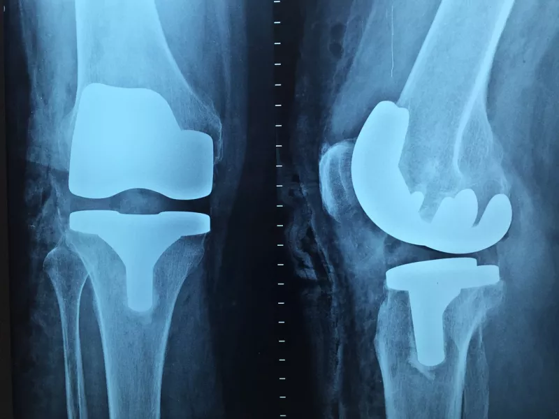 metropolitan pxb knee