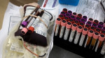 Αιμοδοσία 365 - Καμπάνια ΕΚΠΑ για την εθελοντική αιμοδοσία